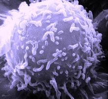 Electron microscope image of a lymphocyte, (a.k.a. cancer cell), September 20, 1976. (Dr. Triche/NCI via Wikipedia). In public domain. 
